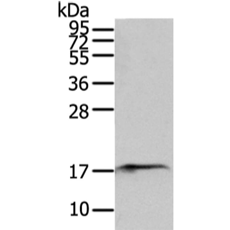 SNX12 Antibody from Signalway Antibody (43331) - Antibodies.com
