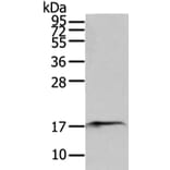 SNX12 Antibody from Signalway Antibody (43331) - Antibodies.com
