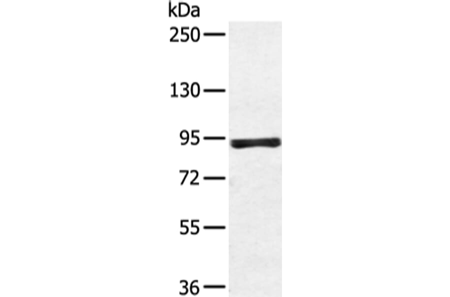 ZFP28 Antibody from Signalway Antibody (43349) - Antibodies.com