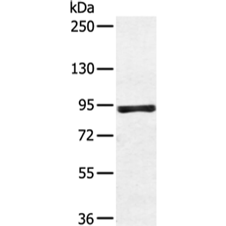 ZFP28 Antibody from Signalway Antibody (43349) - Antibodies.com