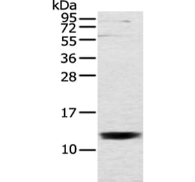 UQCRH Antibody from Signalway Antibody (43353) - Antibodies.com