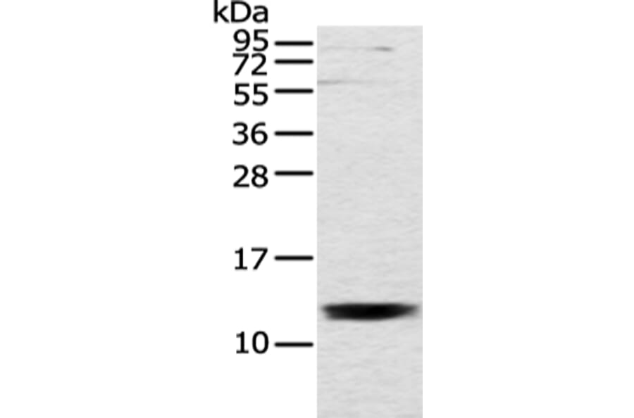 UQCRH Antibody from Signalway Antibody (43353) - Antibodies.com