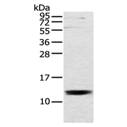 UQCRH Antibody from Signalway Antibody (43353) - Antibodies.com