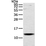 UQCRH Antibody from Signalway Antibody (43353) - Antibodies.com