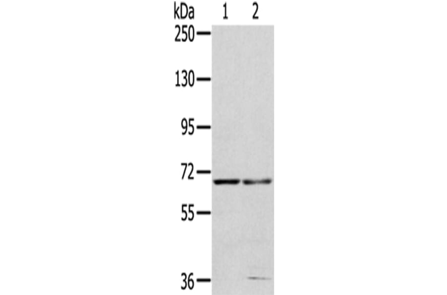 MMP24 Antibody from Signalway Antibody (43400) - Antibodies.com