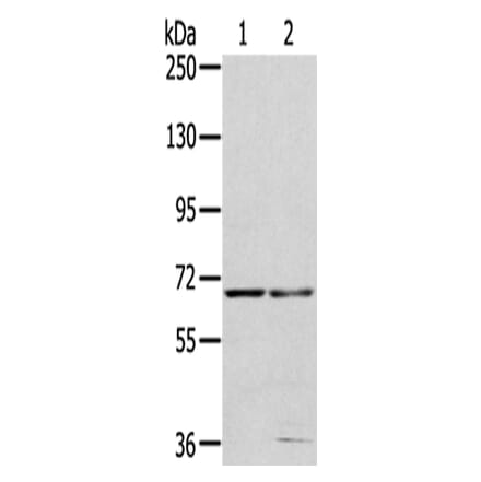 MMP24 Antibody from Signalway Antibody (43400) - Antibodies.com
