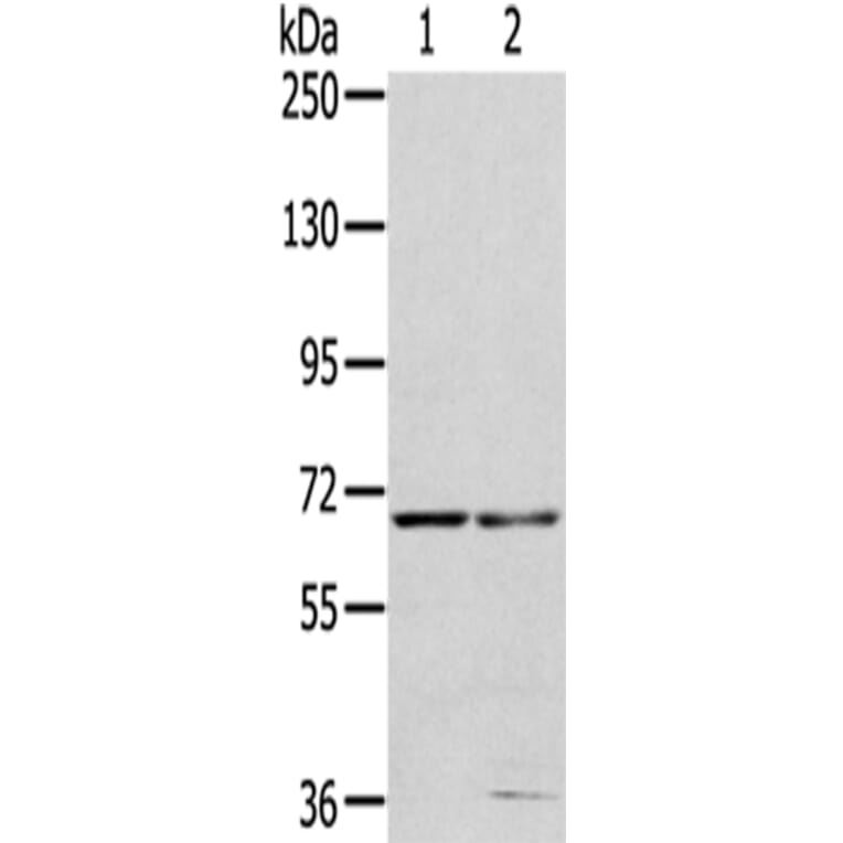 MMP24 Antibody from Signalway Antibody (43400) - Antibodies.com
