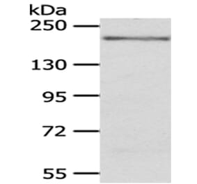 KDM6B Antibody from Signalway Antibody (43401) - Antibodies.com