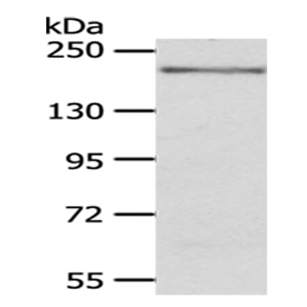 KDM6B Antibody from Signalway Antibody (43401) - Antibodies.com