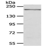 KDM6B Antibody from Signalway Antibody (43401) - Antibodies.com