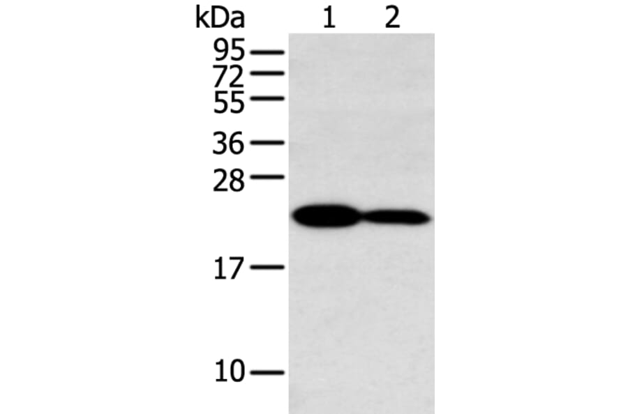 HOXA7 Antibody from Signalway Antibody (43403) - Antibodies.com