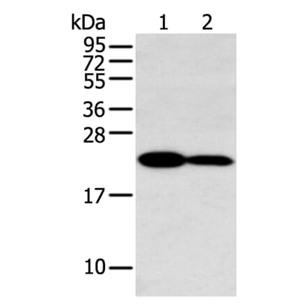 HOXA7 Antibody from Signalway Antibody (43403) - Antibodies.com