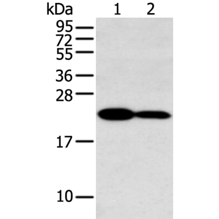 HOXA7 Antibody from Signalway Antibody (43403) - Antibodies.com