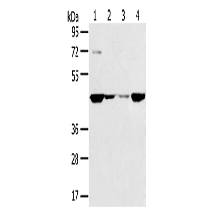 SMYD5 Antibody from Signalway Antibody (43418) - Antibodies.com