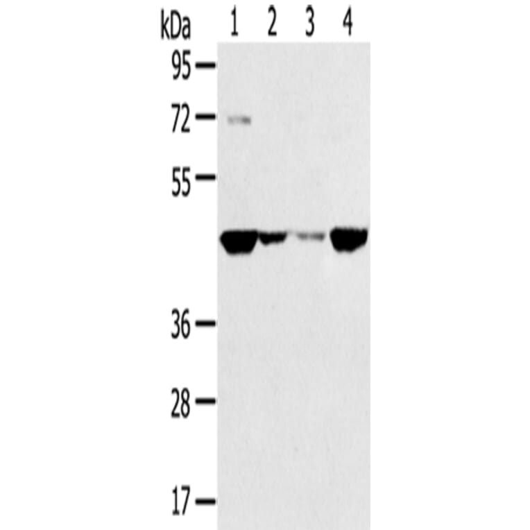 SMYD5 Antibody from Signalway Antibody (43418) - Antibodies.com