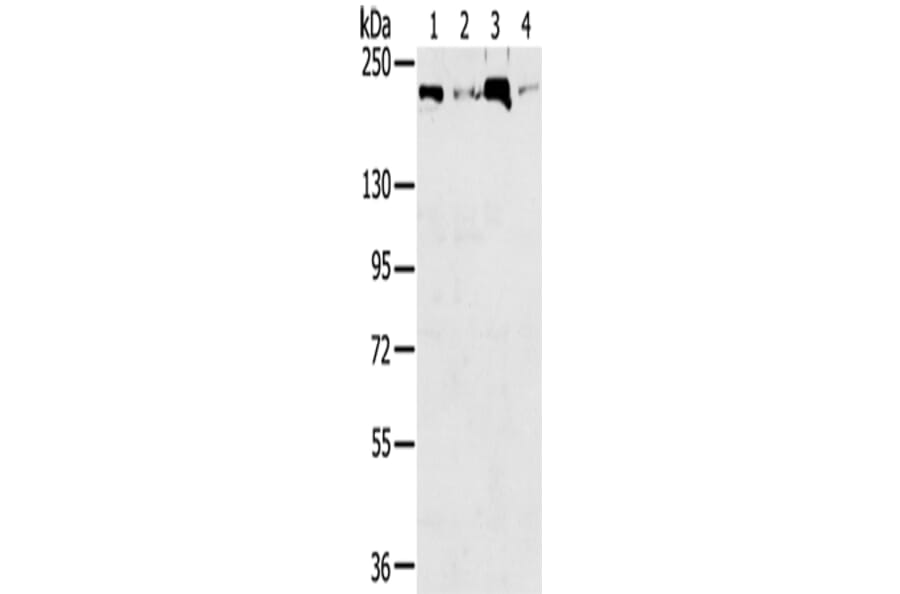 TOP2B Antibody from Signalway Antibody (43422) - Antibodies.com