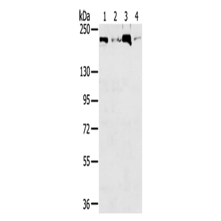 TOP2B Antibody from Signalway Antibody (43422) - Antibodies.com