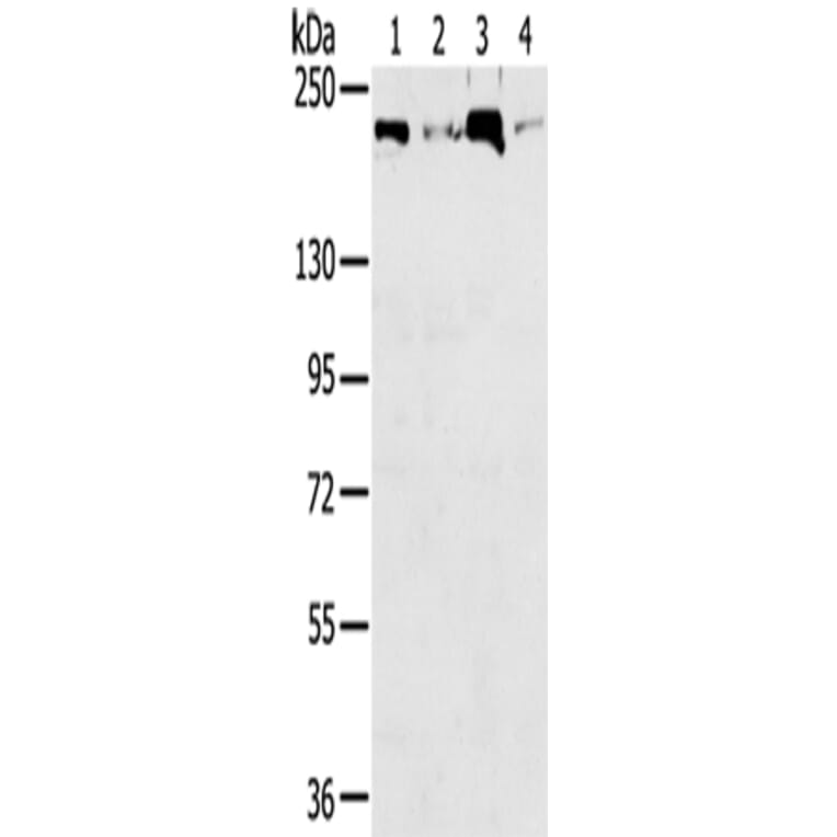 TOP2B Antibody from Signalway Antibody (43422) - Antibodies.com