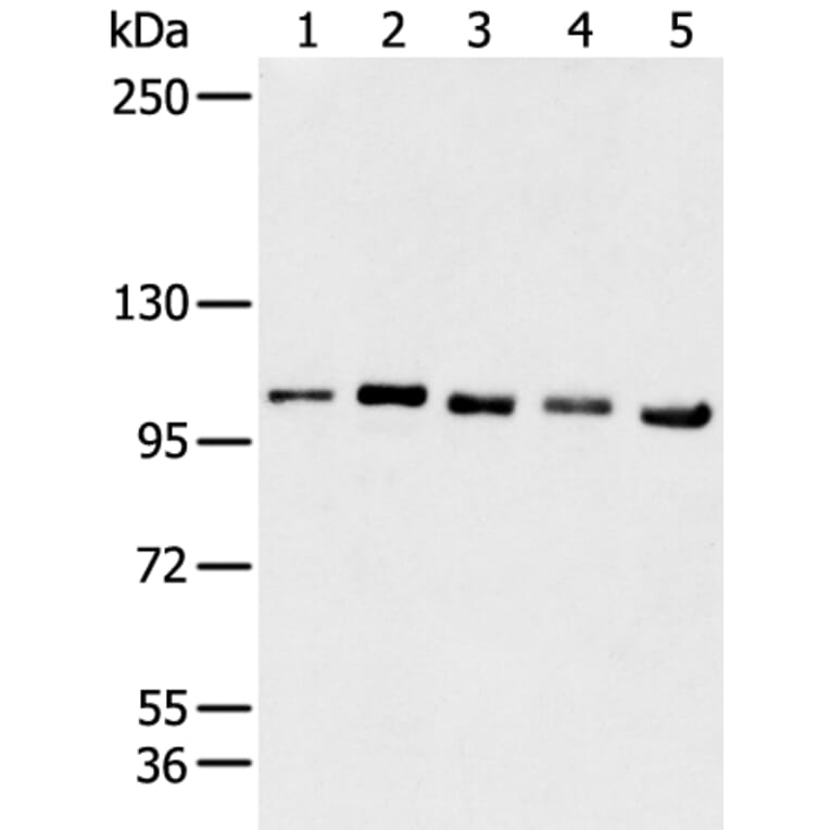 GANAB Antibody from Signalway Antibody (43468) - Antibodies.com