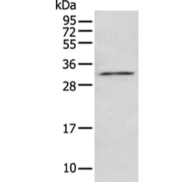 NUDT5 Antibody from Signalway Antibody (43474) - Antibodies.com