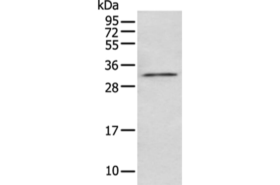 NUDT5 Antibody from Signalway Antibody (43474) - Antibodies.com