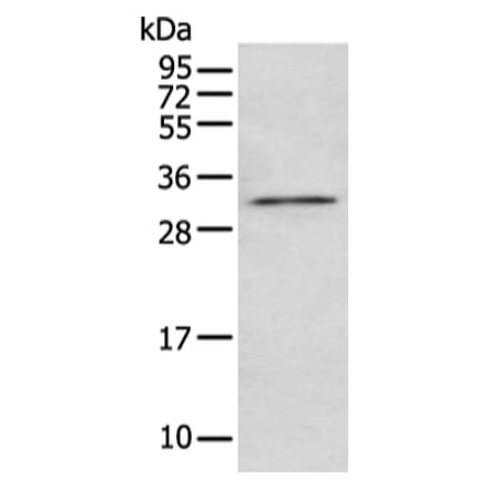 NUDT5 Antibody from Signalway Antibody (43474) - Antibodies.com