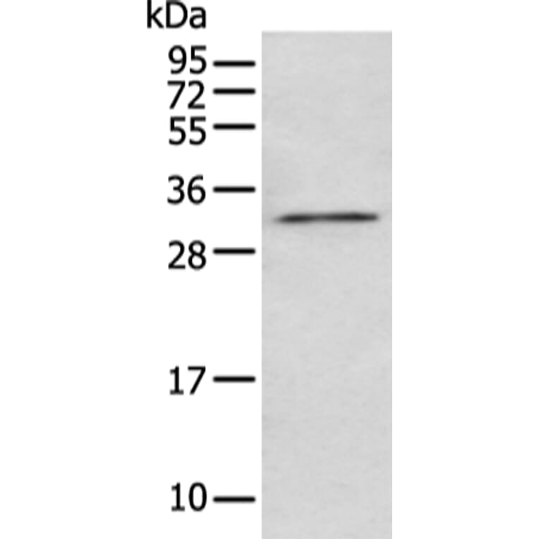 NUDT5 Antibody from Signalway Antibody (43474) - Antibodies.com