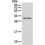 NUDT5 Antibody from Signalway Antibody (43474) - Antibodies.com