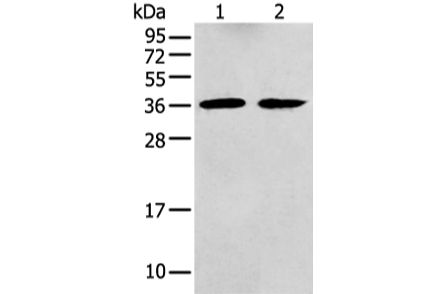 GNAI2 Antibody from Signalway Antibody (43476) - Antibodies.com