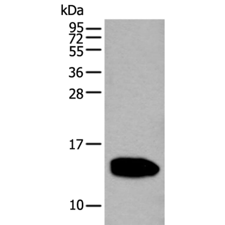REG1A Antibody from Signalway Antibody (43531) - Antibodies.com