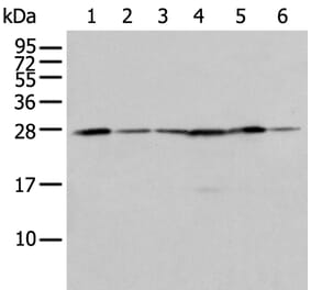 FKBP7 Antibody from Signalway Antibody (43555) - Antibodies.com