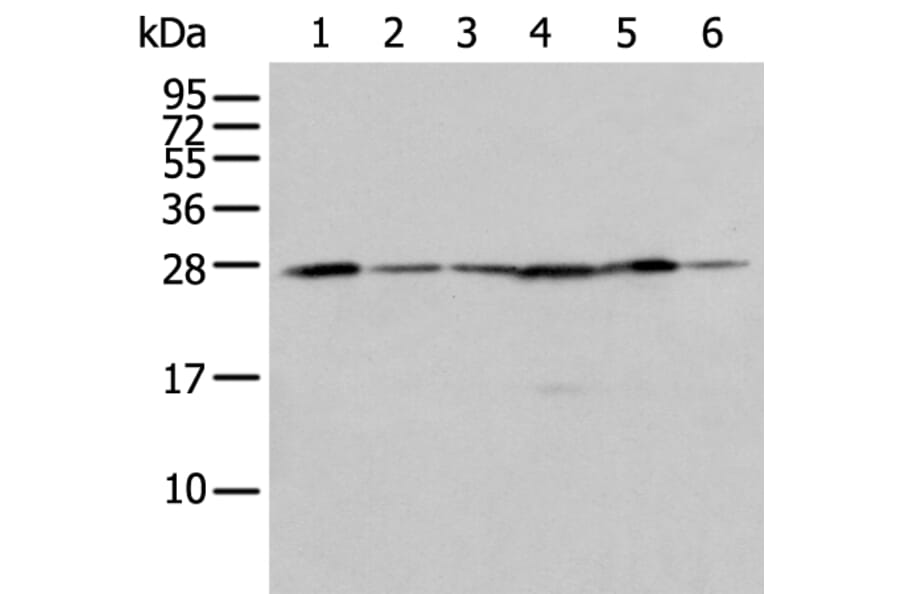 FKBP7 Antibody from Signalway Antibody (43555) - Antibodies.com