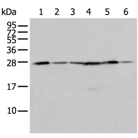 FKBP7 Antibody from Signalway Antibody (43555) - Antibodies.com