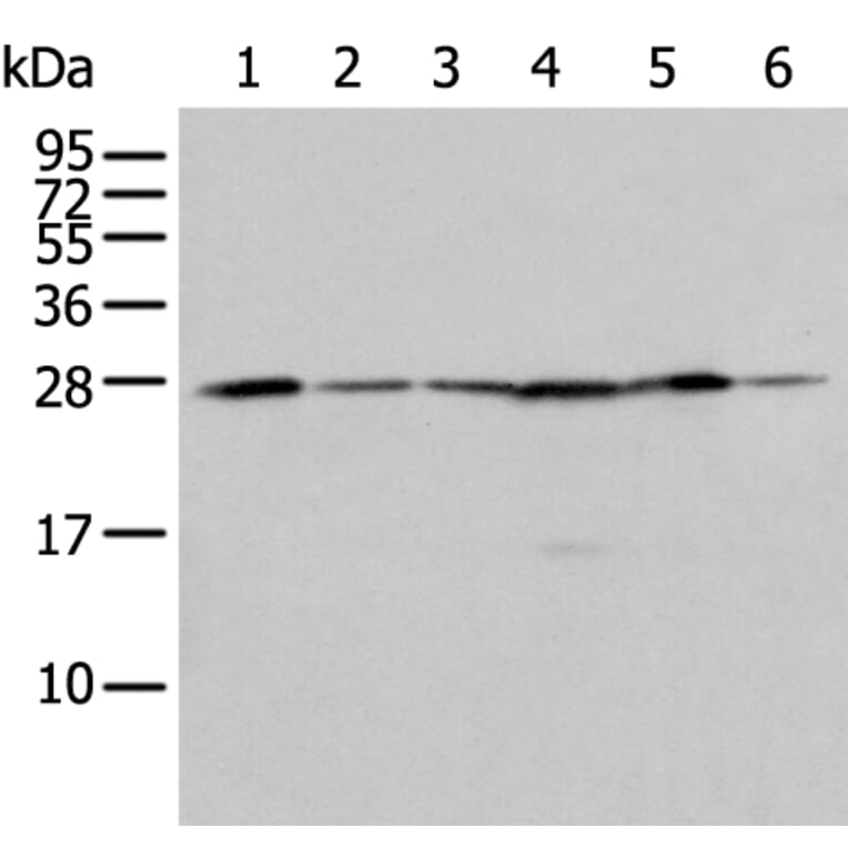 FKBP7 Antibody from Signalway Antibody (43555) - Antibodies.com