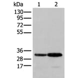 SFXN1 Antibody from Signalway Antibody (43557) - Antibodies.com