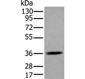 ACAT2 Antibody from Signalway Antibody (43585) - Antibodies.com