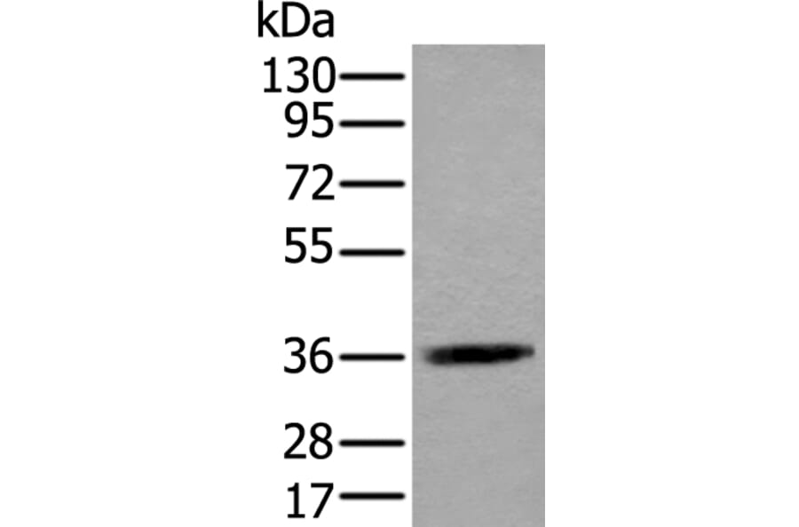ACAT2 Antibody from Signalway Antibody (43585) - Antibodies.com