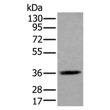 ACAT2 Antibody from Signalway Antibody (43585) - Antibodies.com