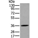 ACAT2 Antibody from Signalway Antibody (43585) - Antibodies.com