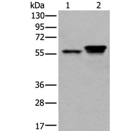 ACVR1 Antibody from Signalway Antibody (43627) - Antibodies.com