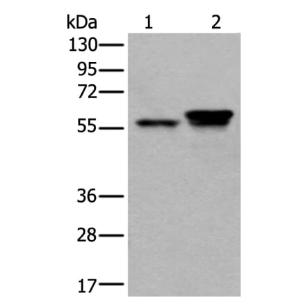 ACVR1 Antibody from Signalway Antibody (43627) - Antibodies.com