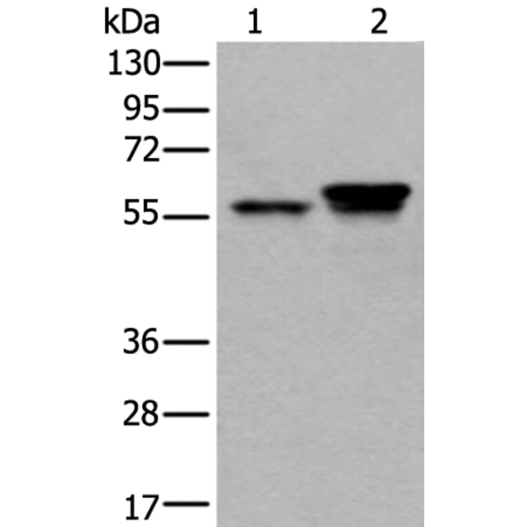 ACVR1 Antibody from Signalway Antibody (43627) - Antibodies.com