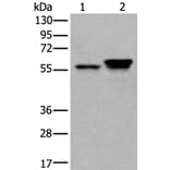 ACVR1 Antibody from Signalway Antibody (43627) - Antibodies.com