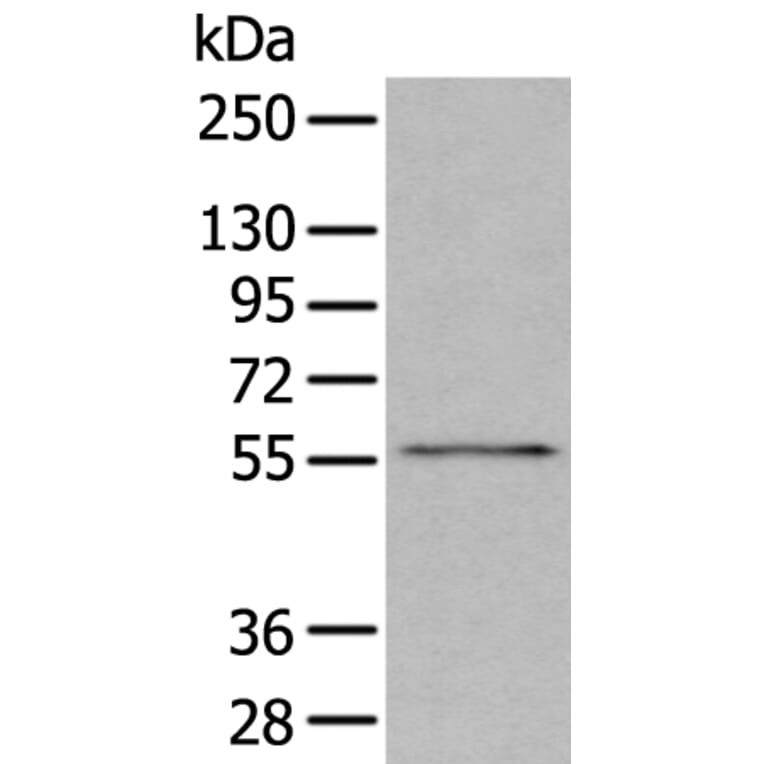 GSK3A Antibody from Signalway Antibody (43681) - Antibodies.com
