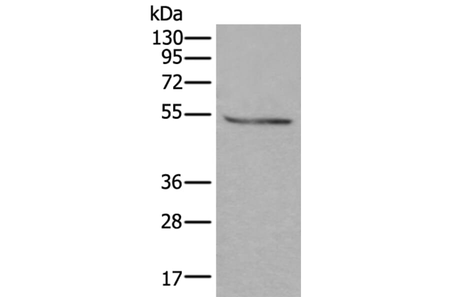 DOK2 Antibody from Signalway Antibody (43719) - Antibodies.com