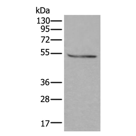 DOK2 Antibody from Signalway Antibody (43719) - Antibodies.com