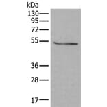 DOK2 Antibody from Signalway Antibody (43719) - Antibodies.com