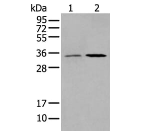 HOXB5 Antibody from Signalway Antibody (43731) - Antibodies.com