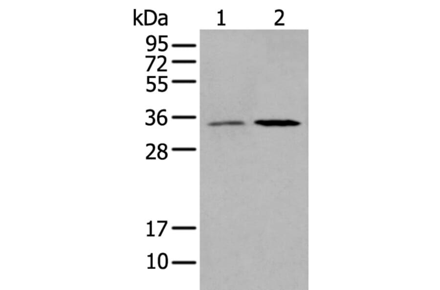 HOXB5 Antibody from Signalway Antibody (43731) - Antibodies.com