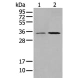 HOXB5 Antibody from Signalway Antibody (43731) - Antibodies.com